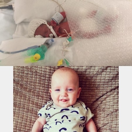 Baby Carter as a pre-mature baby and as a healthy baby now